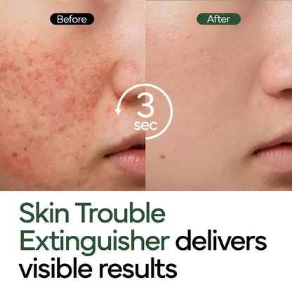 Final 3 Hours:70%OFF🔥Intensive Cica Repair Cream