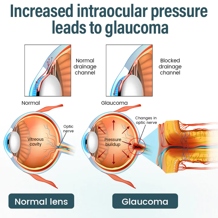 LOVILDS® OptiFusion Nano Eye Drops Serum