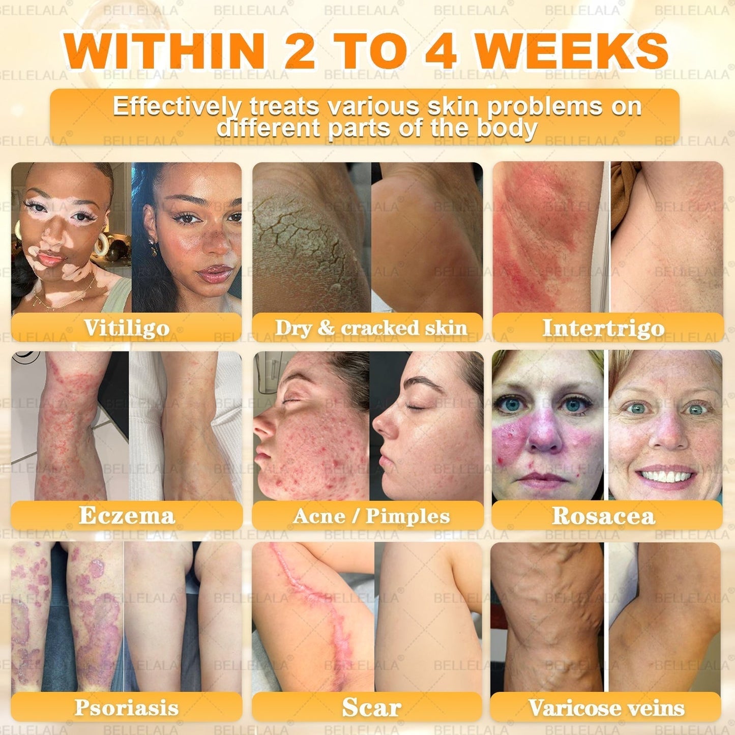 NEW & IMPROVED ✨Bellelala® 𝖡𝖾𝖾 𝗏𝖾𝗇𝗈𝗆 𝖲𝗄𝗂𝗇 𝖱𝖾𝗌𝗍𝗈𝗋𝖺𝗍𝗂𝗈𝗇 𝖢𝗋𝖾𝖺𝗆