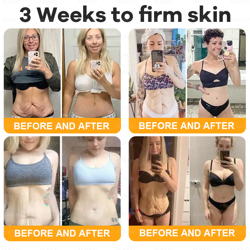 Made and Shipped from USA ✨ VLSVLS® Bee Venom Skin Restoration Cream 🌸 Anti-aging,Hydrating, Skin Repair, Even Tone, Acne and Dark Spot Treatment, Wart and Mole Removal, Psoriasis Relief CS 🔥 LAST DAY 80% OFF 💎