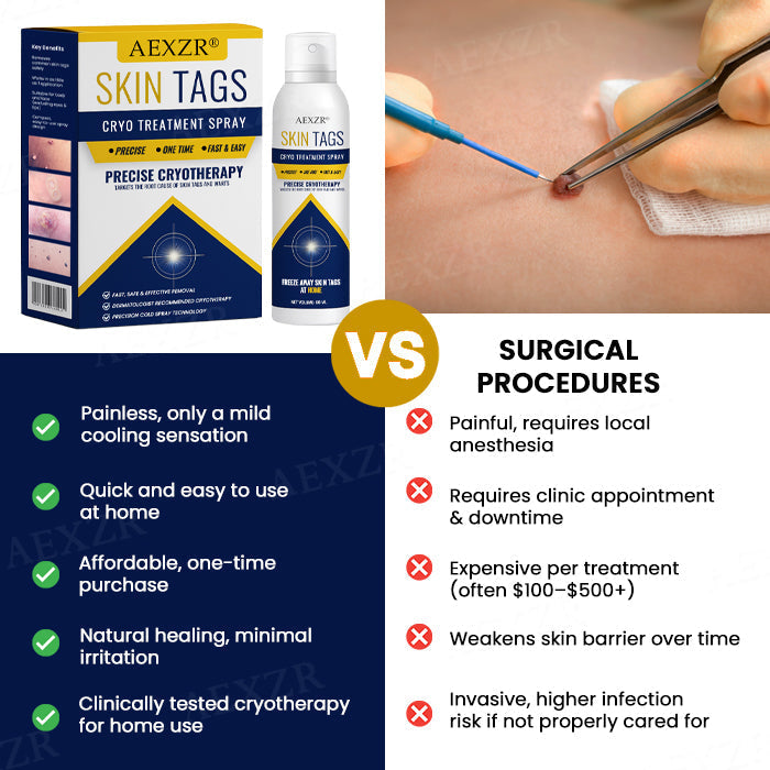 AEXZR® Skin Tag Cryo Treatment Spray🧊 Precision Cryo-Tech: Freezes Away Skin Tags & Warts in Seconds – No Blades, No Pain.