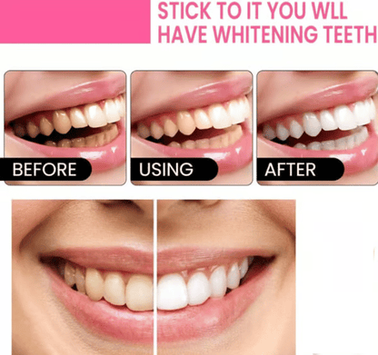 🔥Nicotinamide Probiotic Whitening Toothpaste - Free of Fluoride, Nicotinamide, Anti plaque