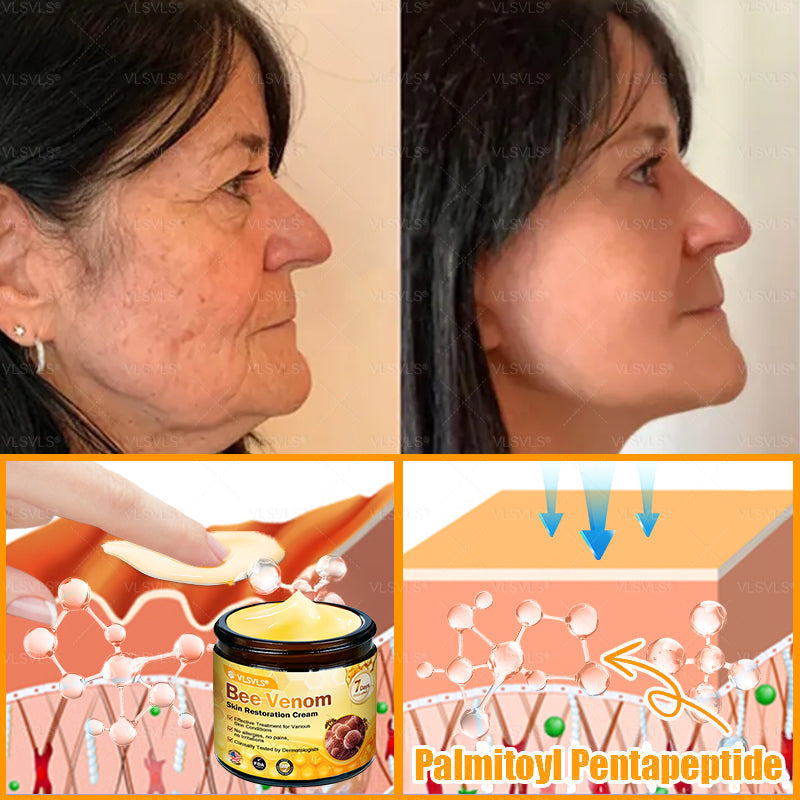 Made and Shipped from USA ✨ VLSVLS® Bee Venom Skin Restoration Cream 🌸 Anti-aging,Hydrating, Skin Repair, Even Tone, Acne and Dark Spot Treatment, Wart and Mole Removal, Psoriasis Relief CS 🔥 LAST DAY 80% OFF 💎