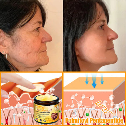 Made and Shipped from USA ✨ VLSVLS® Bee Venom Skin Restoration Cream 🌸 Anti-aging,Hydrating, Skin Repair, Even Tone, Acne and Dark Spot Treatment, Wart and Mole Removal, Psoriasis Relief CS 🔥 LAST DAY 80% OFF 💎